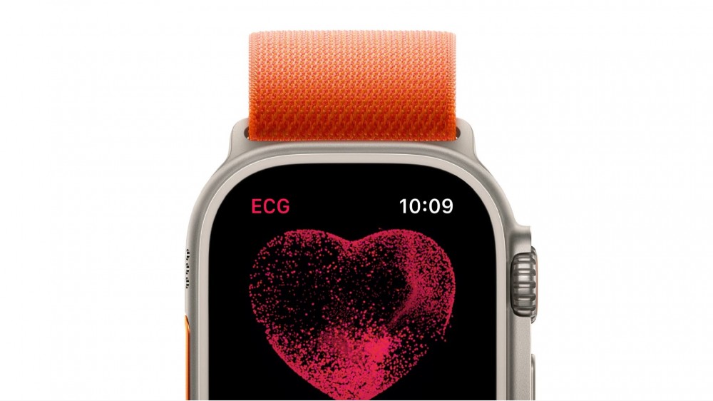 Apple Watch Ultra ECG (EKG)